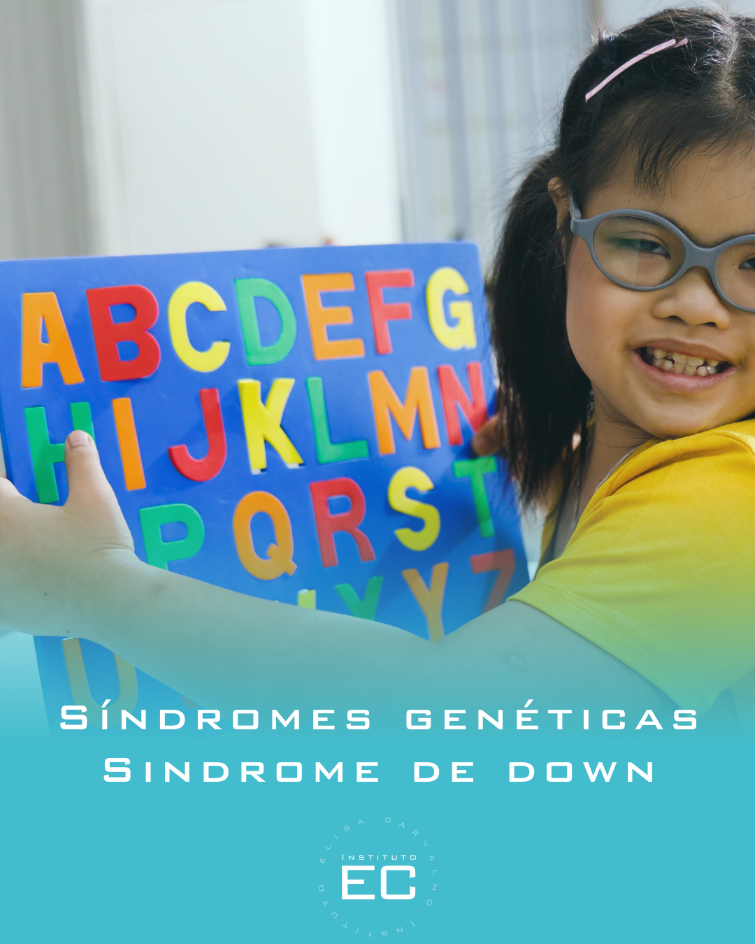Síndromes genéticas Sindrome de down